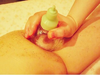 アペイサー 京都本店(Apaiser)/【カッピング】凸凹脂肪スライド