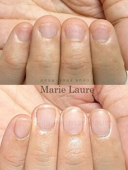 マリーロール 淀屋橋本店(Marie Laure)/自爪育成/深爪矯正/ネイルケア