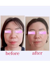 ブロッサム 山内店/フェイスリリース★2回目