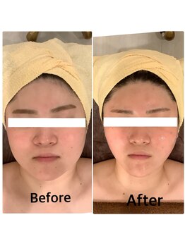 スペチアーレ 夙川/小顔と美肌で美顔革命