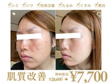 ピュアノア 垂水店