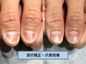 アリエ(allie)/シンプルに爪をきれいにしたい