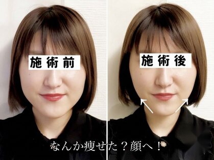 アオヤマ サロン ワイゼット(AOYAMA SALON YZ)の写真