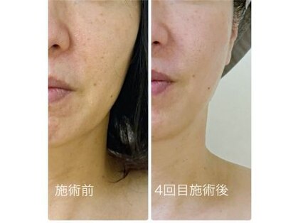 アリビオ(alivio)の写真
