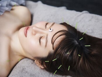 シンク(CINQ)の写真/ハリツヤに特化した鍼技法！トップ鍼灸師のみ施術可能な『次世代フェイシャル美容鍼』