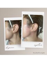 ブラジリアンワキシング シックスナイン(BrazilianWaxing69)/女性 / もみあげ