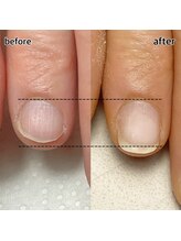 スマイルニコ(smile nico)/