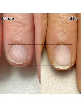 スマイルニコ(smile nico)/