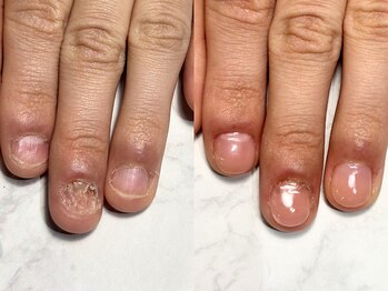 アリエ(allie)/見た目！120分で別人級変化！