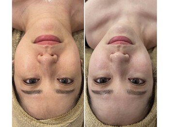 アグテ(Agte)/OPEN限定モニター☆フルデザイン