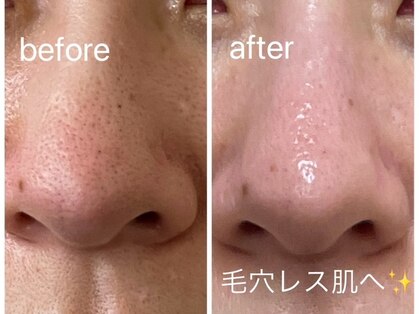 クレビア(Crebia)の写真