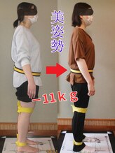 チャラク(charaku)/【40代Y様：痩身+肩こり+姿勢】