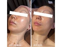 ダナン(danan)の雰囲気（韓国肌管理／水光肌Gloss肌ピーリングで、うるおい満ちる艶肌へ）