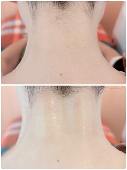 オムの写真/【今すぐ毛を綺麗にしたい方へ】石井のオムで叶う！プロのシェービング×肌ケアで即効垢ぬけツルスベ肌
