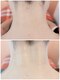 オムの写真/【今すぐ毛を綺麗にしたい方へ】石井のオムで叶う！プロのシェービング×肌ケアで即効垢ぬけツルスベ肌

