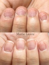マリーロール 梅田店(Marie Laure)/自爪育成/深爪矯正/ネイルケア
