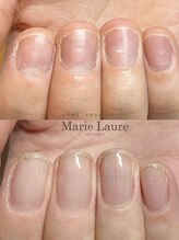 マリーロール 淀屋橋本店(Marie Laure)/自爪育成/深爪矯正/ネイルケア