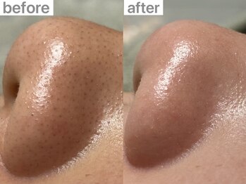 ユイット ルッカ(Huit Lucca)/ハイドラ×アクアダーマ