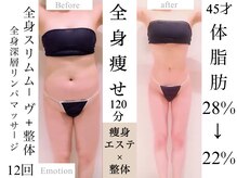 痩身×整体の良いとこ取り♪ぽっちゃり体型を卒業しませんか？