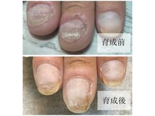 トラブルネイルにも対応できるスタッフ在籍！