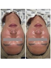 サラン(SALON)/メンズ　ビフォーアフター