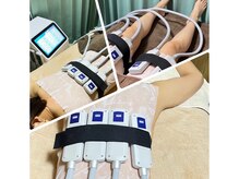 エステサロン JJシャンハイの雰囲気（脂肪冷却で理想の美脚へ♪EMS機能付/痩身/ダイエット/太もも）