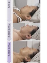 ミャオ(Meow!)/チタニウムリフト