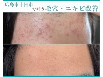 シーズン(Season)の写真