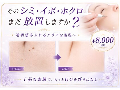クラリス(Clarice)の写真