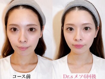 イーズ ららぽーと湘南平塚店(E/S)/