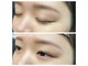 アルセ(Arce)の写真