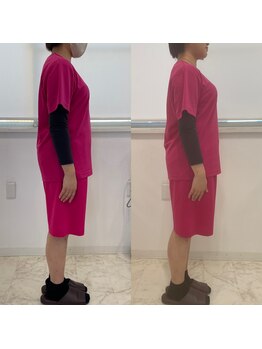 ギャラクシービューティー(galaxy beauty)/肩甲骨