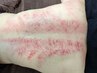 【ボディ/カッサ】かっさ上半身集中 美肌石トリートメント 90分