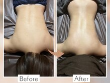 ラモアナ 京橋店(lamoana)/痩身アロマ　結果♪