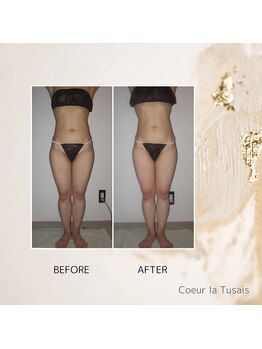 クーラ テュセ(Coeur la Tusais)/【40歳まで】全身まるごと痩身