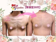 アンジェリークBB バストパレット本店の雰囲気（【緊張型バストケア】デコルテに力が入りやすい方。育乳コースA）