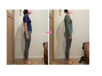 ラーナビコツ(RANA-bikotsu)/BEFORE-AFTER