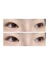 ブライズ(BRISE)/ラッシュリフト