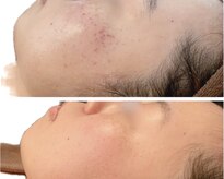 シンゲツ(SHINGETSU)