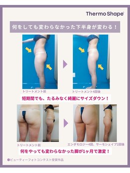 エステティック ライム(Esthetic Lime)/世界的美容テクノロジーラジオ波