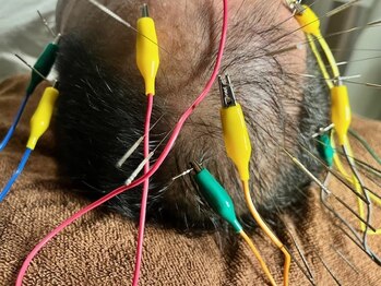 ヘッドサイエンス(HEADSCIENCE)/鍼に電気を流し育毛促進ブースト