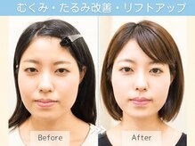 シンメトリー たまプラーザテラス店の雰囲気（左右差/たるみ/ほうれい線/むくみ/肌のくすみ/トーンアップ）