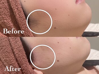 レーヴ(REVE)/フェイシャルWAX（もみあげ）