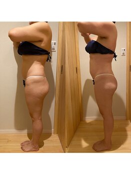 凪 横浜/痩身エステ１回での結果