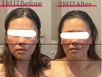 サロン ジジ(salon JiJi)/韓国小顔コルギ