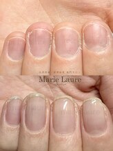 マリーロール 淀屋橋本店(Marie Laure)/自爪育成/深爪矯正/ネイルケア