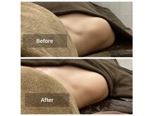 巻き肩改善♪美しい姿勢に導きます！