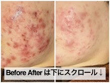 おうちサロン ミキ/ビフォーアフターは下にたくさん