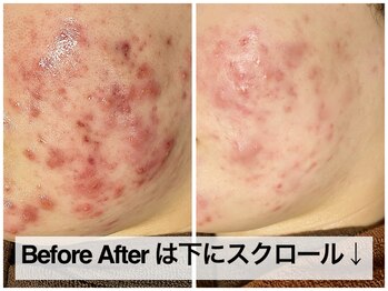 おうちサロン ミキ/ビフォーアフターは下にたくさん