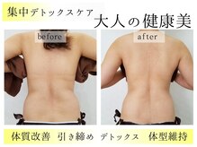 ラッシュビューティー(LASH Beauty)の雰囲気（お顔も体も【本気の悩み】には【徹底ケア&サポート】を全力で！）